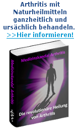 Arthritis behandeln